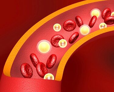 Add-On Therapy Approved to Lower LDL Cholesterol in High-Risk Patients