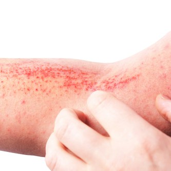 Getting Started with Dermatology: A Clinician’s Guide to a Career in Skin Health 